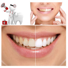 Load image into Gallery viewer, Whitening Teeth Powder for Oral Hygiene