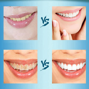 Whitening Teeth Powder for Oral Hygiene